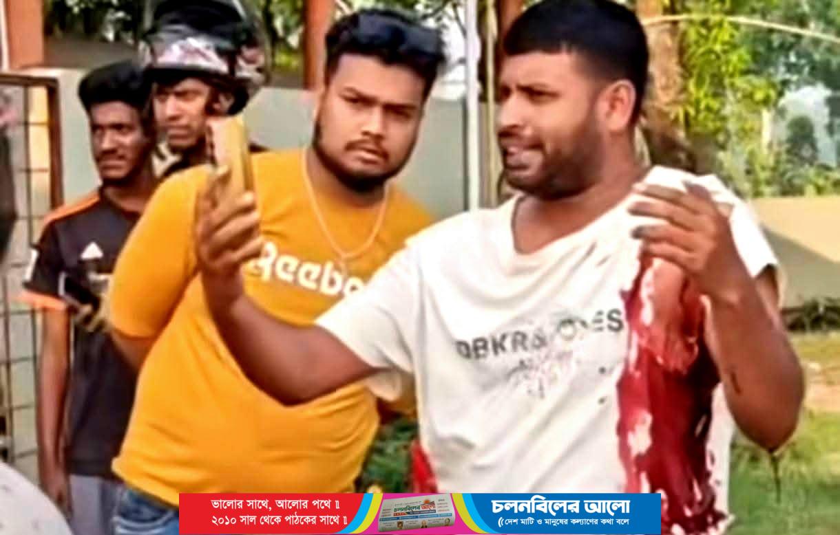 ঈশ্বরদীতে মোটরসাইকেলে পেট্রোল নিতে গিয়ে র*ক্তা*ত্ত হলেন যুবক