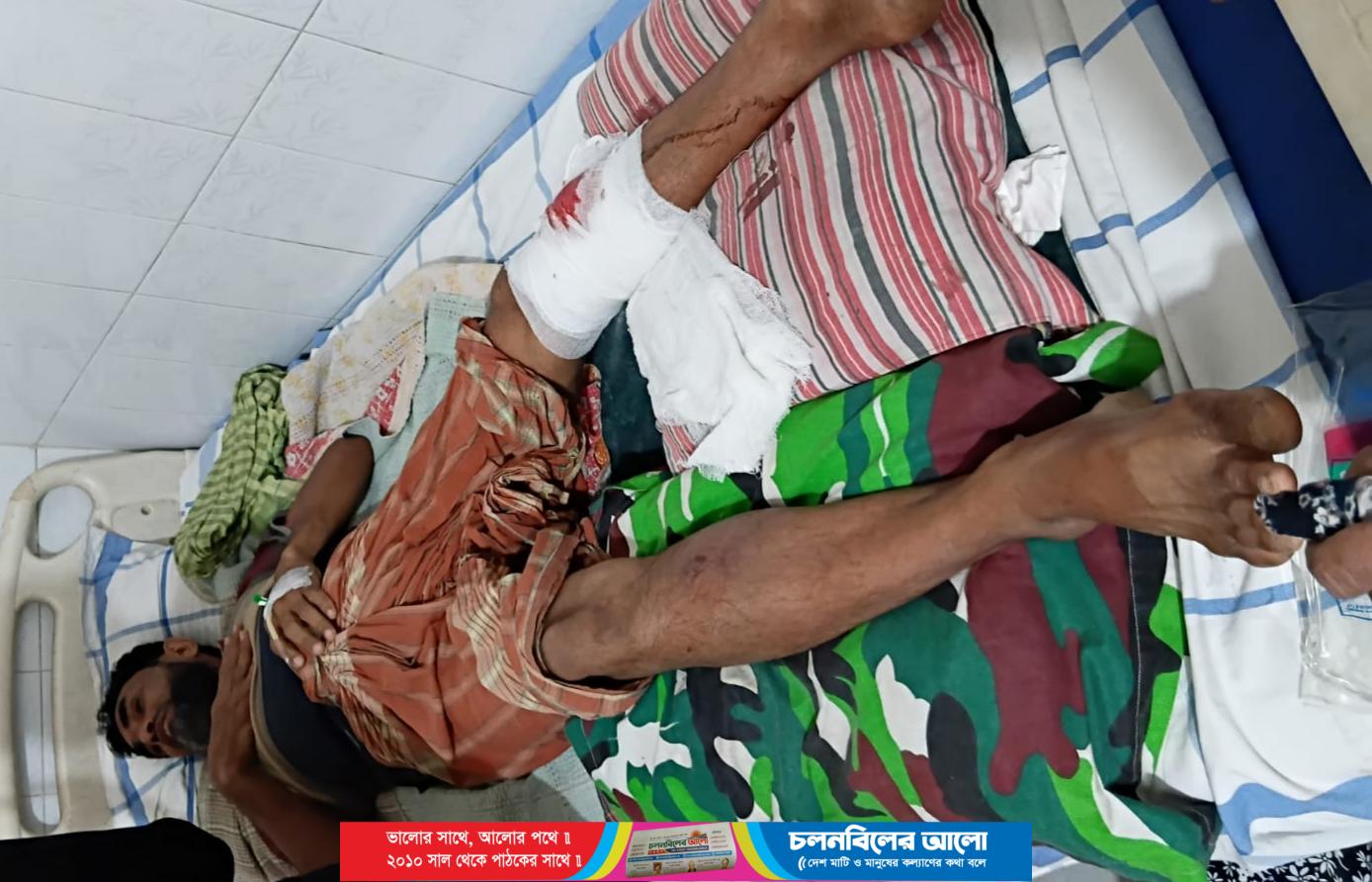 আটঘরিয়ায় ফজলুল হককে হ*ত্যা*চে*ষ্টা: দুই পা গুঁড়িয়ে দিলেও অধরা আসামিরা