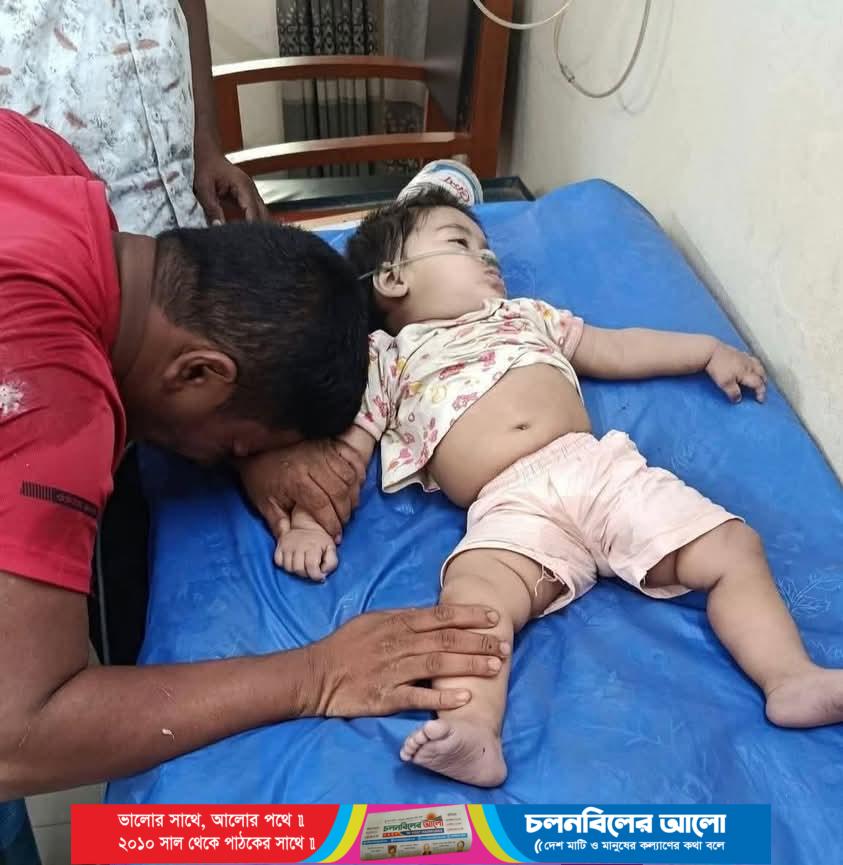 বমু বিলছড়িতে গলায় লিচুর বিচি আটকে ১০ মাসের শিশুর মৃত্যু