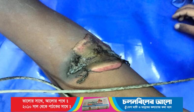 চাটমোহরে ঝড়ে ছিঁড়ে পড়া তারে বিদ্যুতায়িত হয়ে ৭ বছরের শিশুর মৃত্যু, মা গুরুতর আহত