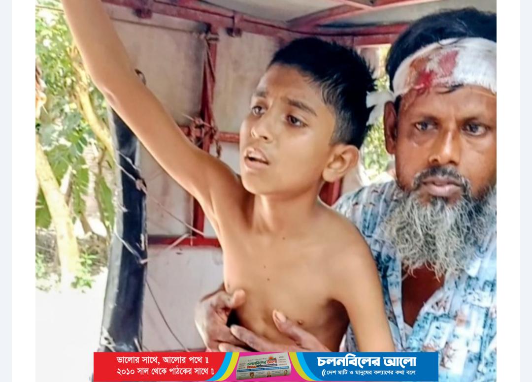 আটঘরিয়ায় অটোরিকশা নিয়ন্ত্রণ হারিয়ে গাছে ধাক্কা দুই শিশুসহ ৬ জন আহত
