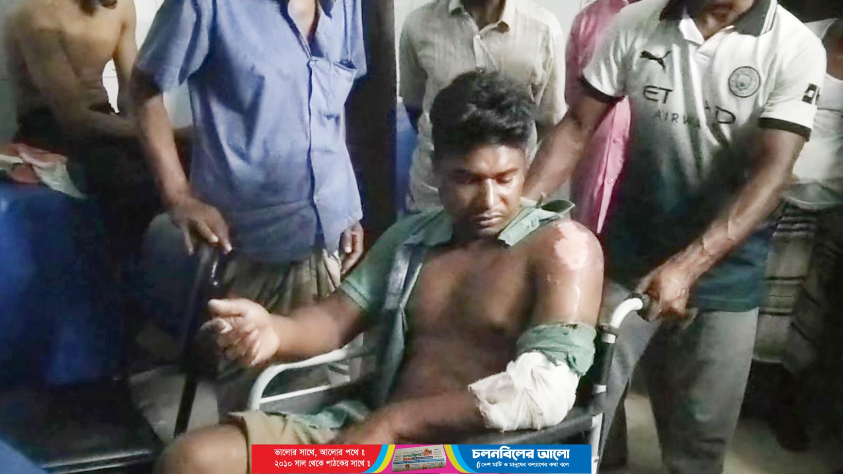 আটঘরিয়ায় পূর্ব বিরোধের জেরে এক ব্যক্তিকে পিটিয়ে জখম হাসপাতালে ভর্তি