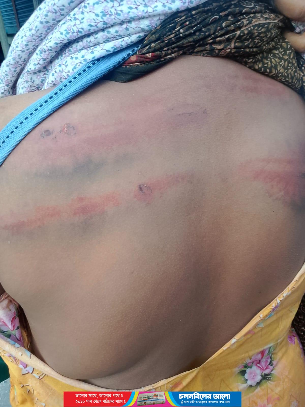 চৌহালীতে নারী নির্যাতনের অভিযোগ: ন্যায় বিচারের দাবি পরিবারের
