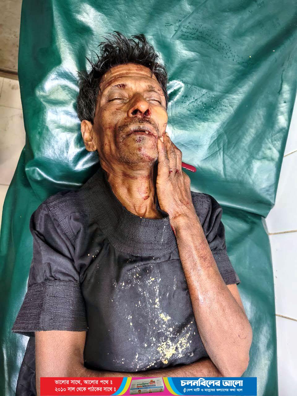 গোপালপুরে ভ্যান থেকে পড়ে আহত বৃদ্ধের মৃত্যু