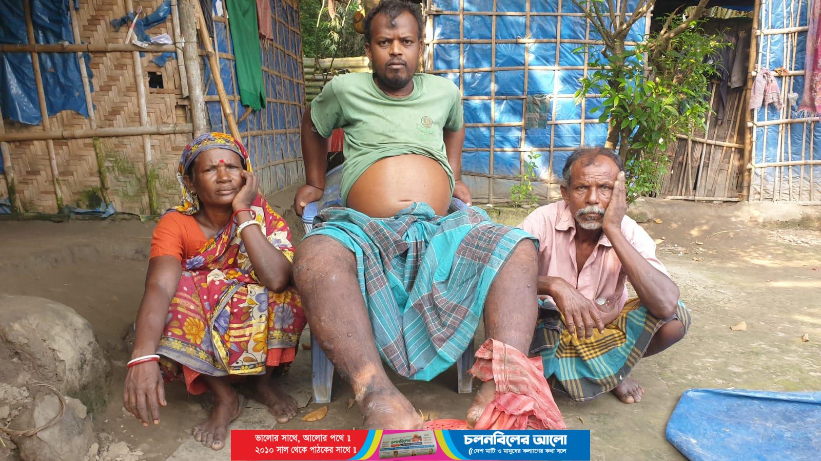 জরাজীর্ণ ঘরে মানবেতর জীবন, চিকিৎসার অভাবে কাতরাচ্ছেন পলাশ পাহান